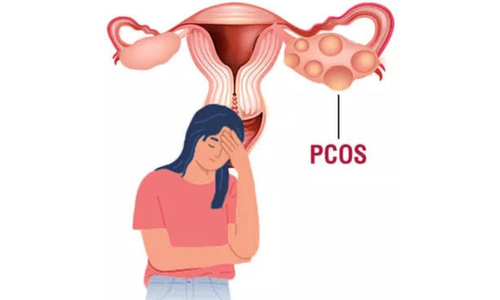 PCOS İçin Tohum Döngüsü Protokolü